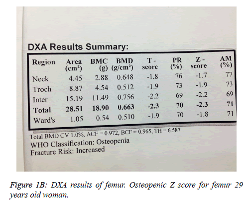 biomedres-femur-Osteopenic