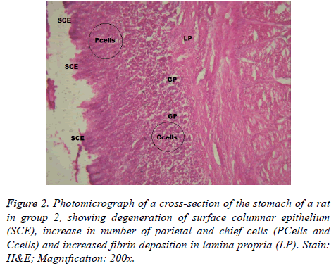 biomedres-fibrin-deposition