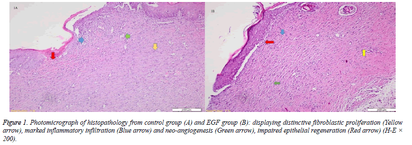 fibroblastic-proliferation-inflammatory