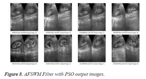 biomedres-filter-PSO