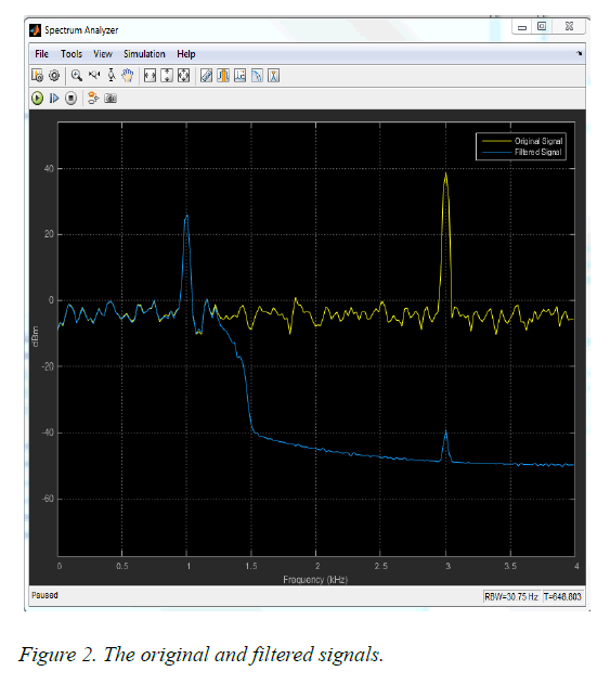 biomedres-filtered-signals