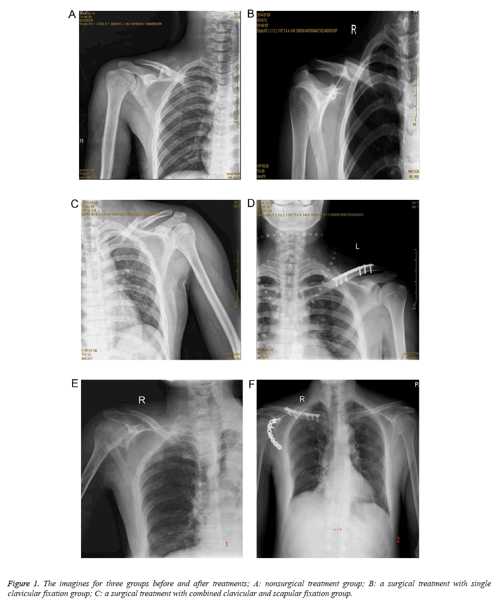 biomedres-fixation-surgical