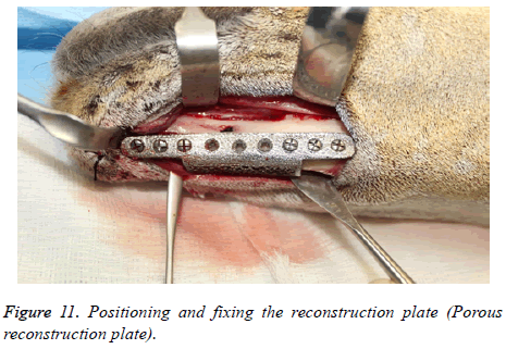 biomedres-fixing-reconstruction-plate
