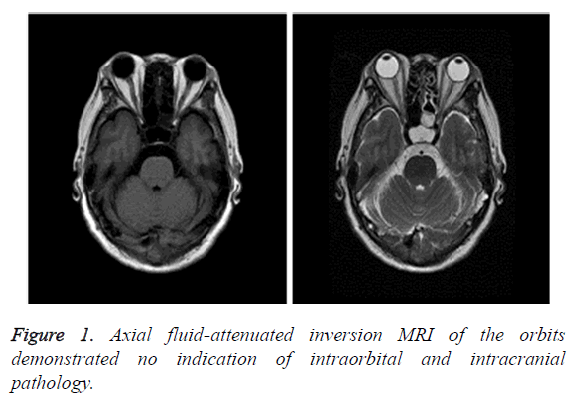 biomedres-fluid-attenuated