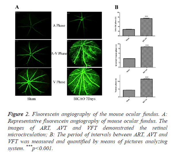 biomedres-fluorescein-angiography