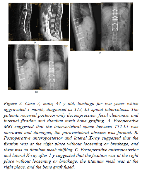 biomedres-focal-clearance