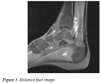 biomedres-foot-image