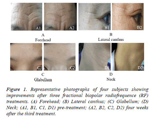 biomedres-fractional-biopolar