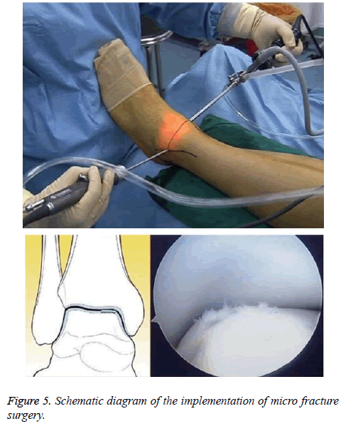 biomedres-fracture-surgery