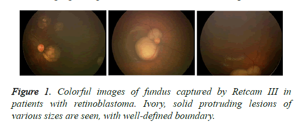 biomedres-fundus-captured