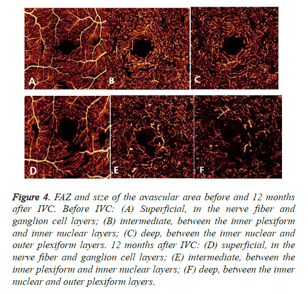 biomedres-ganglion-cell