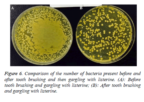 biomedres-gargling-listerine