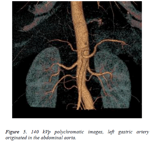 biomedres-gastric-artery