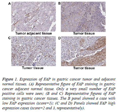 biomedres-gastric-cancer