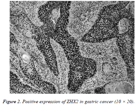 biomedres-gastric-cancer