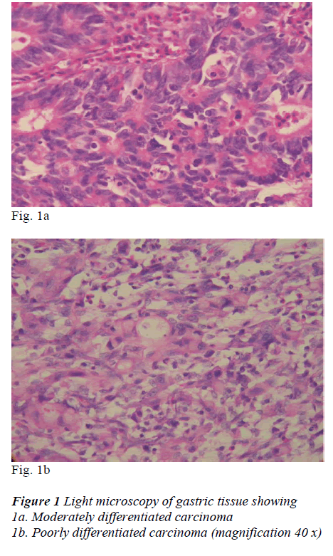 biomedres-gastric-tissue-showing