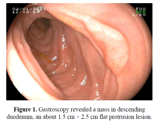 biomedres-gastroscopy-revealed