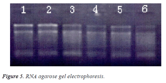 biomedres-gel-electrophoresis