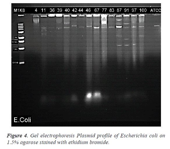 biomedres-gel-electrophoresis