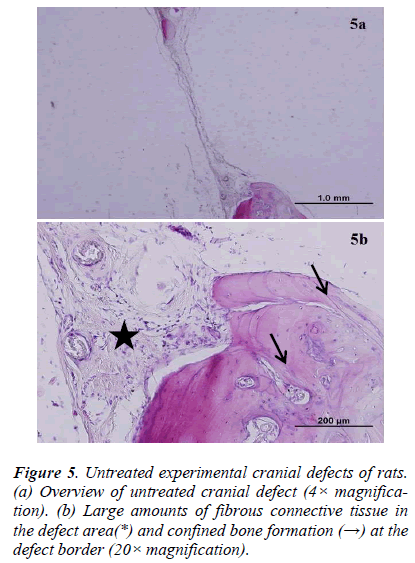 biomedres-grafts-parietal-rats-new-bone