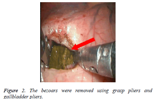 biomedres-grasp-pliers