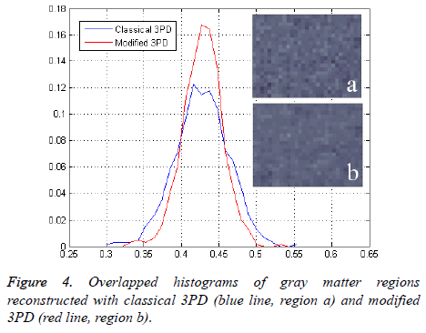 biomedres-gray-matter-regions