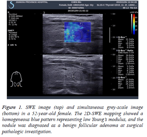 biomedres-grey-scale-image