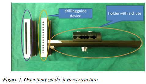 biomedres-Osteotomy-guide