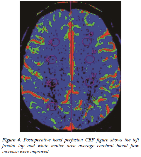 biomedres-head-perfusion