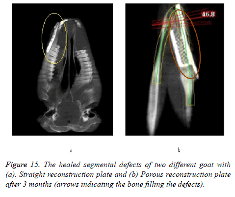 biomedres-healed-segmental