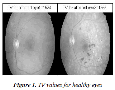 biomedres-healthy-eyes