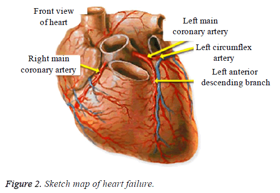 biomedres-heart-failure