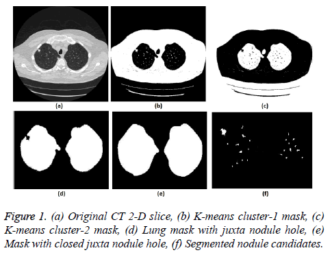 biomedres-heart-juxta-nodule