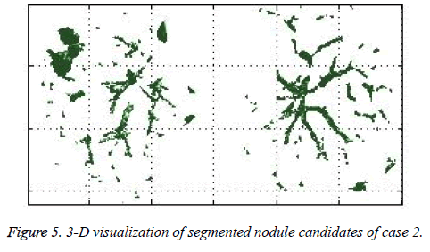 biomedres-heart-segmented