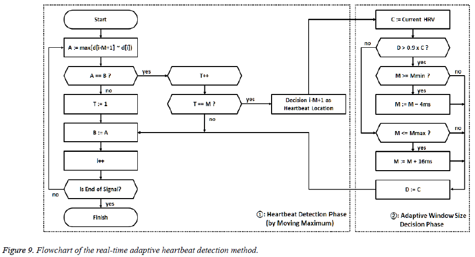 biomedres-heartbeat-detection-method