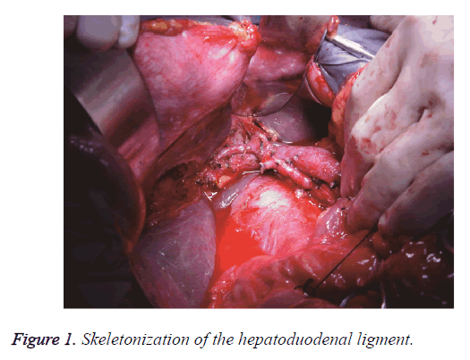 biomedres-hepatoduodenal-ligment