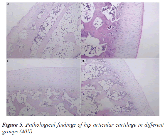 biomedres-hip-articular-cartilage