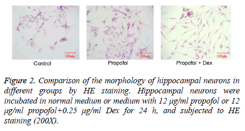 biomedres-hippocampal-neurons