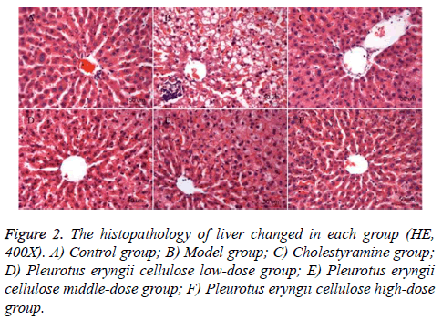 biomedres-histopathology-liver