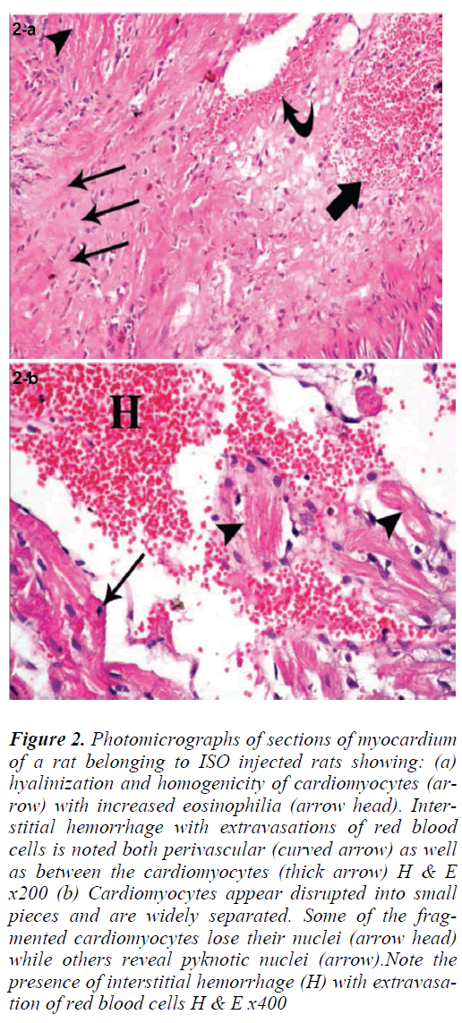 biomedres-hyalinization-homogenicity-cardiomyocytes