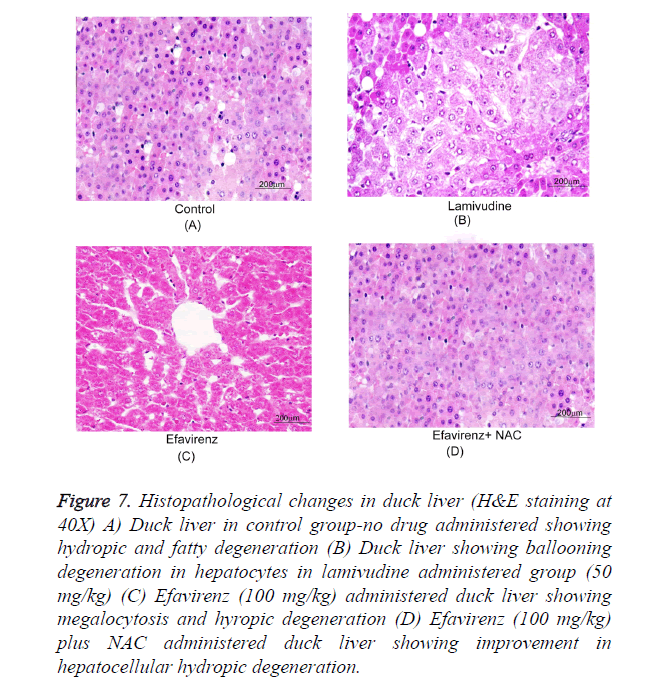 biomedres-hydropic-degeneration