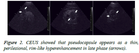 biomedres-hyperenhancement