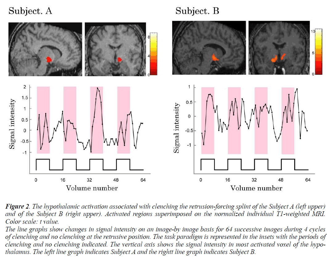 biomedres-hypothalamic-activation