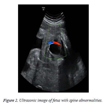 biomedres-image-fetus