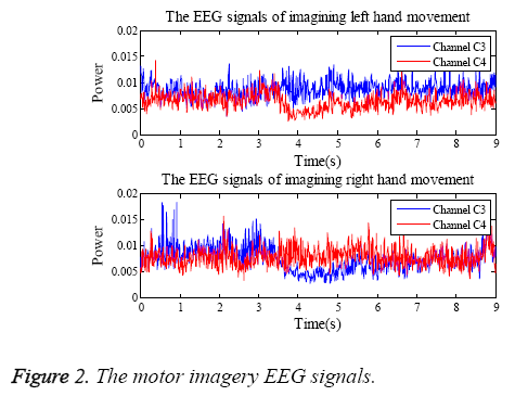 biomedres-imagery-EEG-signals