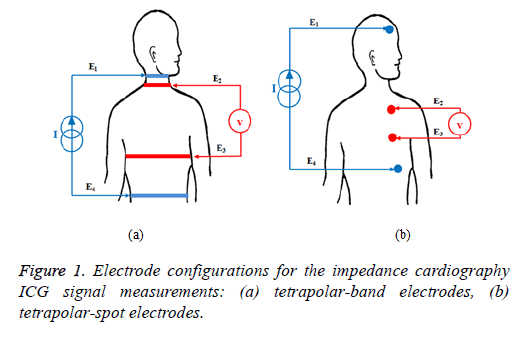 biomedres-impedance-cardiography