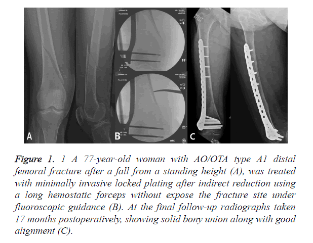 biomedres-indirect-reduction