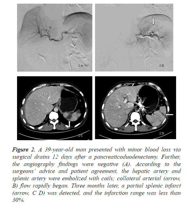 biomedres-infarction-range