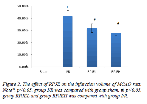 biomedres-infarction-volume