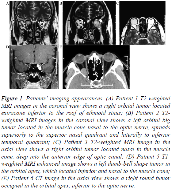 biomedres-inferior-optic-nerve